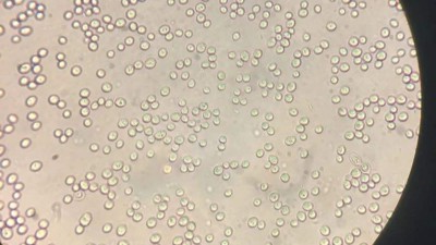 水解啤酒废酵母生产蛋白饲料的酶制剂有哪些？