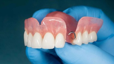 酶制剂——口腔健康守护者